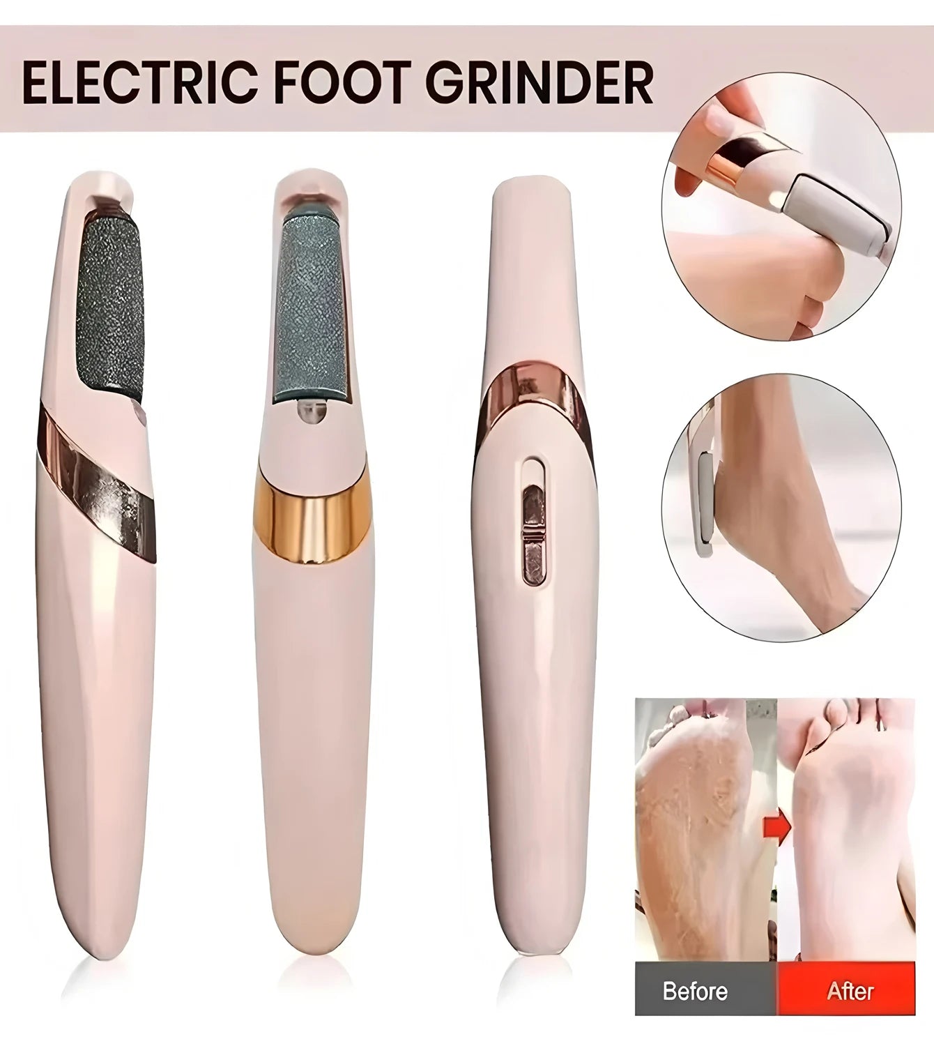 Electric Callus Remover
